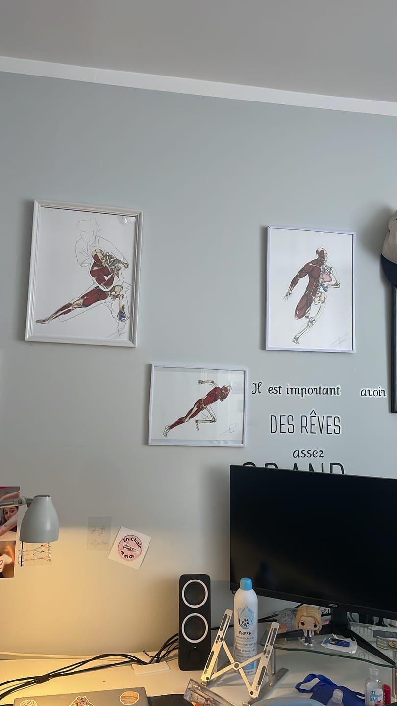 Customer photo review of Planche anatomique du sprinteur