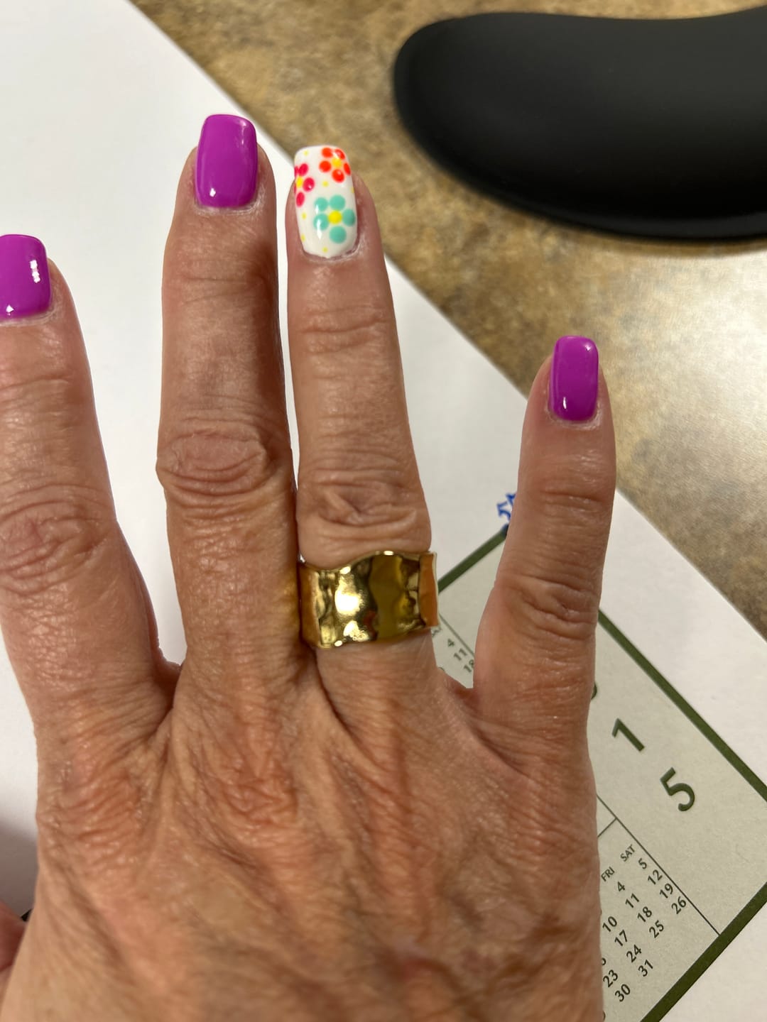 Customer photo review of Textured Band Ring