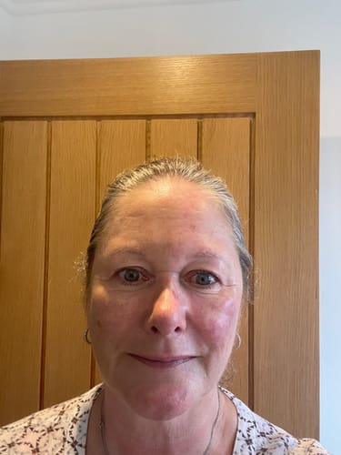 Customer photo review of Rosalique 3 in 1 Anti-Redness Miracle Formula SPF50