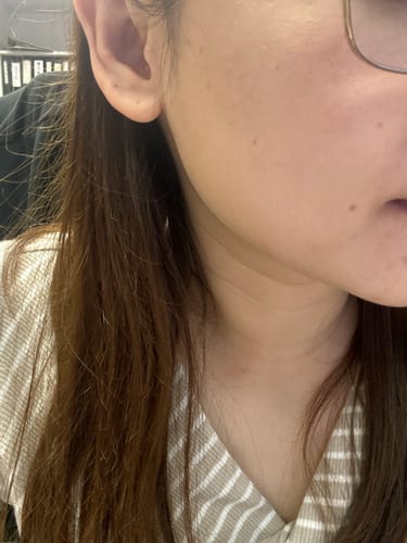 Customer photo review of Ulike X DingDing 聯名超光炮美容儀