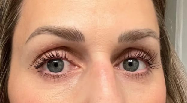 Customer photo review of Suero crecimiento de pestañas y cejas