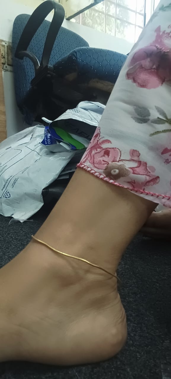 Customer photo review of Snake Chain Anklet