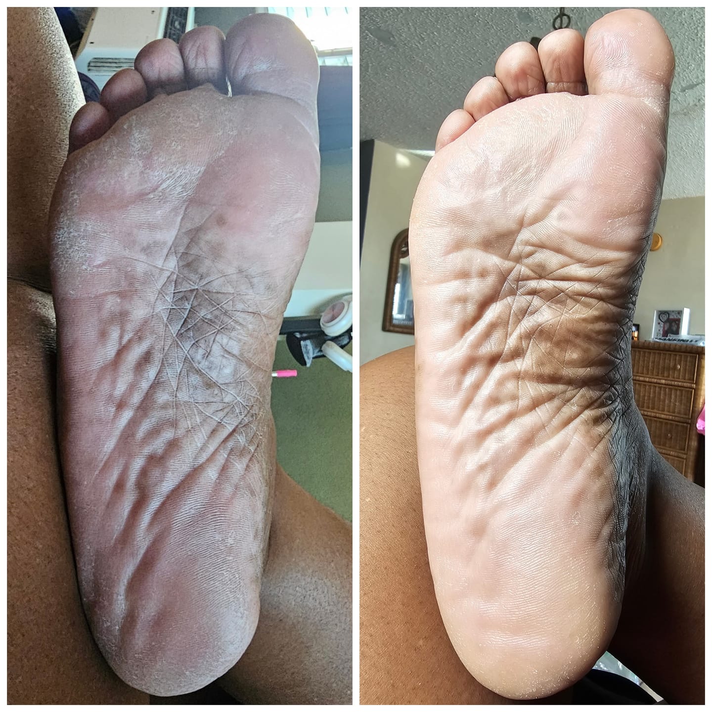 Customer photo review of Foot Balm