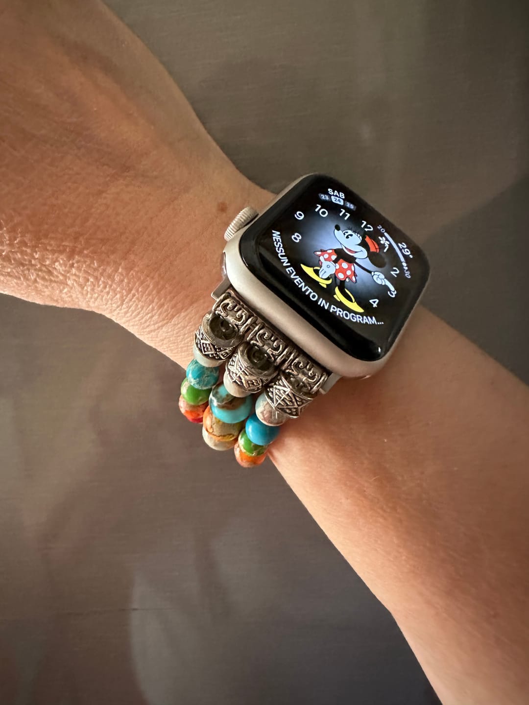 Customer photo review of Vibrant Chakra Stretch Apple Watch Strap