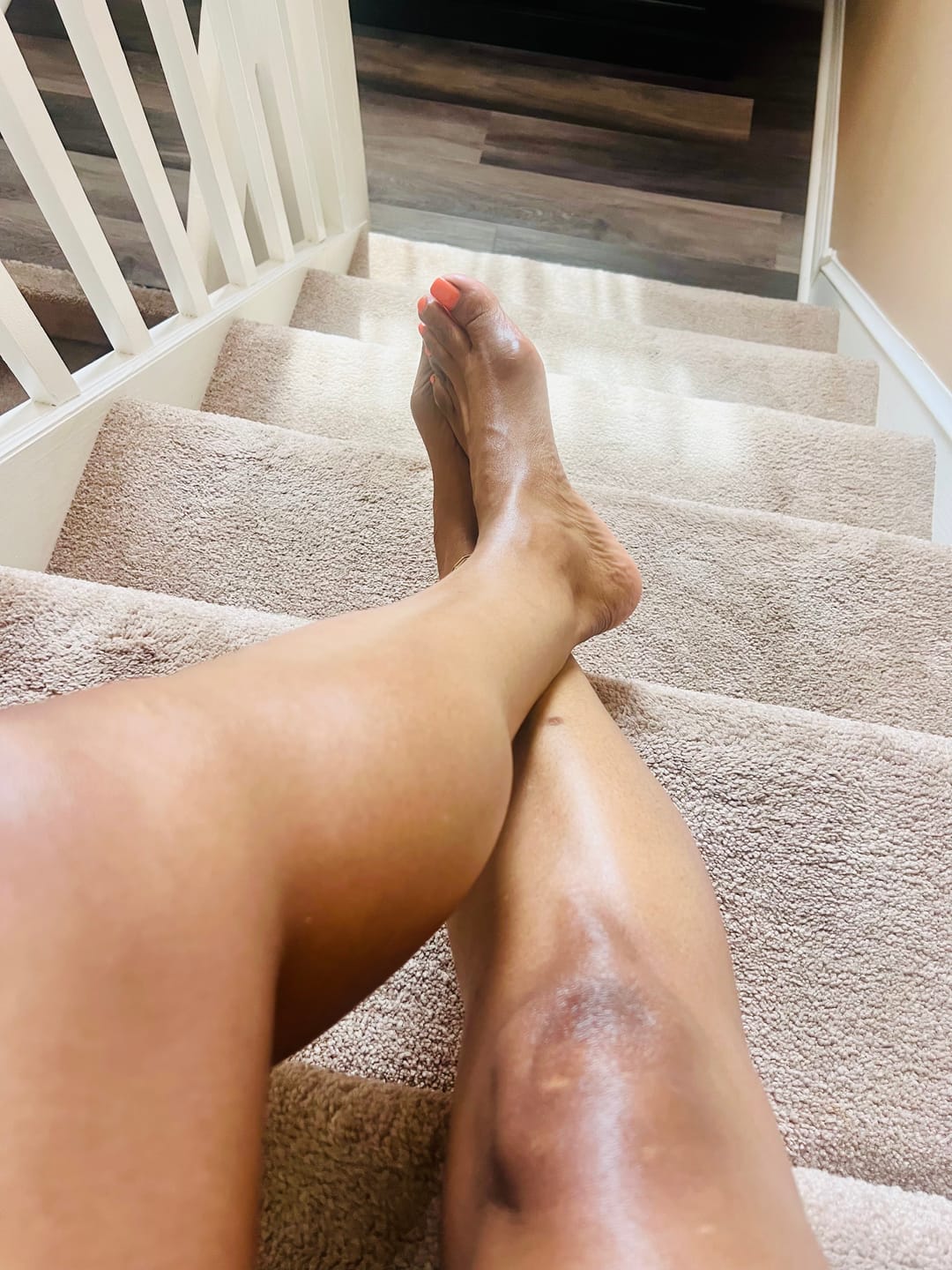 Customer photo review of True Glow ORIGINAL