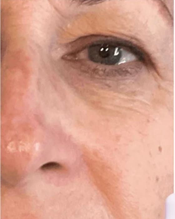 Customer photo review of Under Eye Skincare Wand