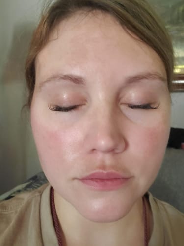 Customer photo review of Dermave™ Deep Collagen Mask