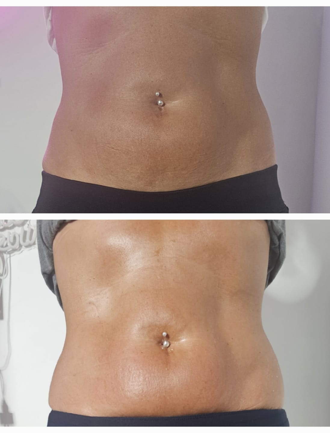 Customer photo review of Adonis 6 in 1 Cavitation Machine for Fat Blasting