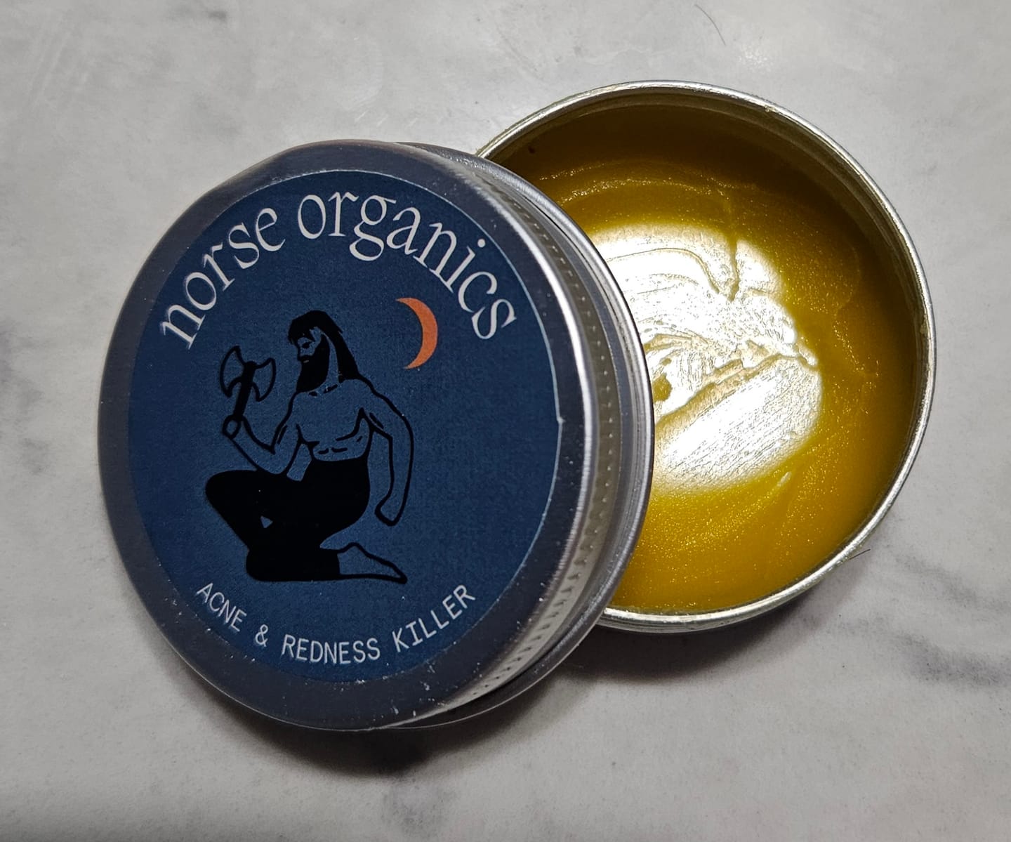 Customer photo review of Acne & Redness Killer