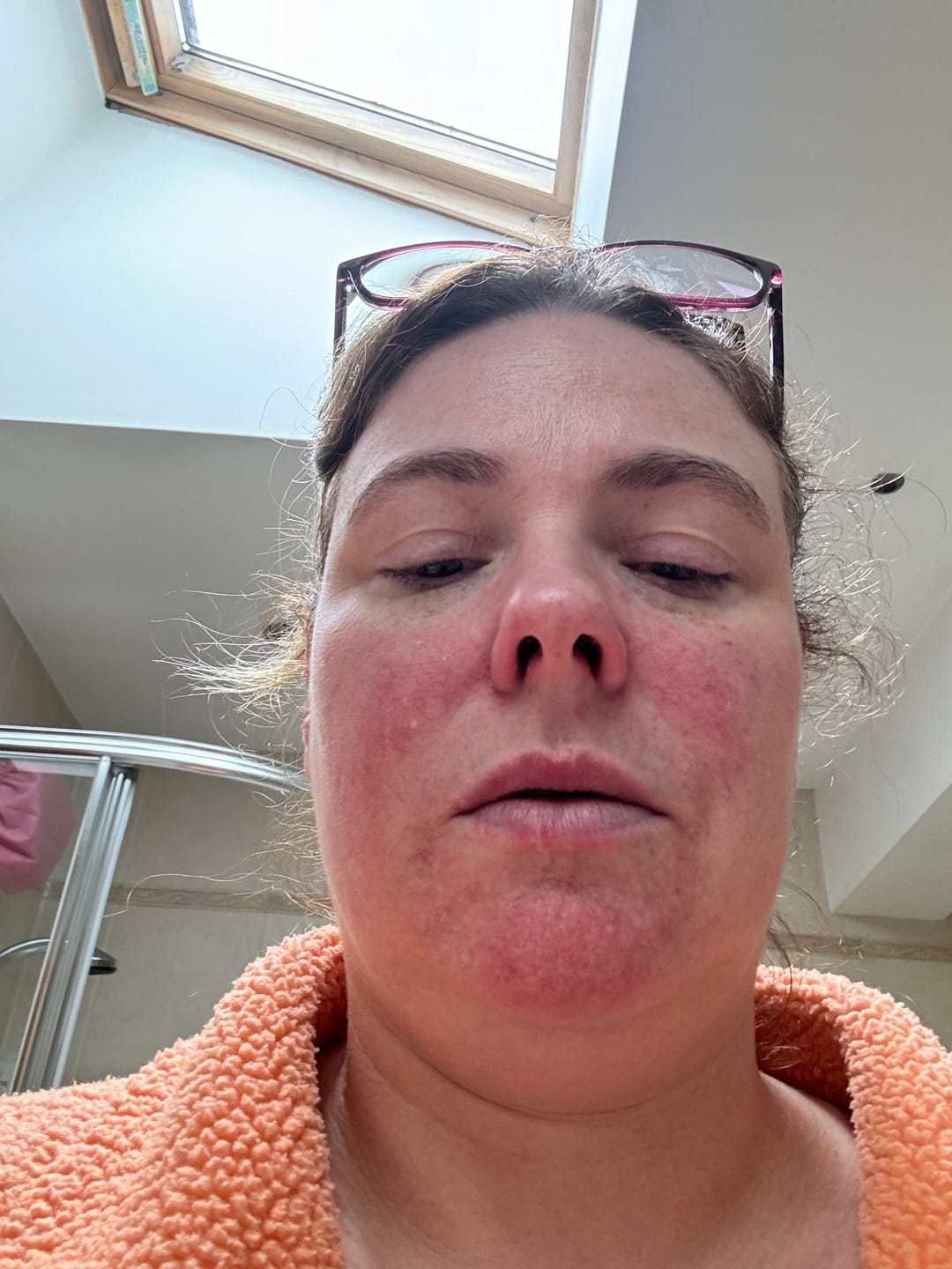 Customer photo review of Rosalique 3 in 1 Anti-Redness Miracle Formula SPF50