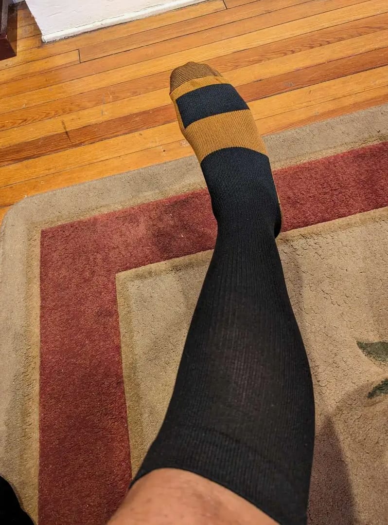 Customer photo review of Armadilo Performance Compression Socks