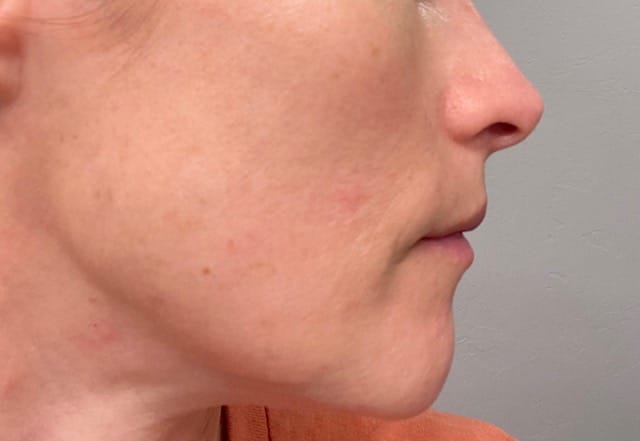 Customer photo review of Anti-Age & Glow Ritual