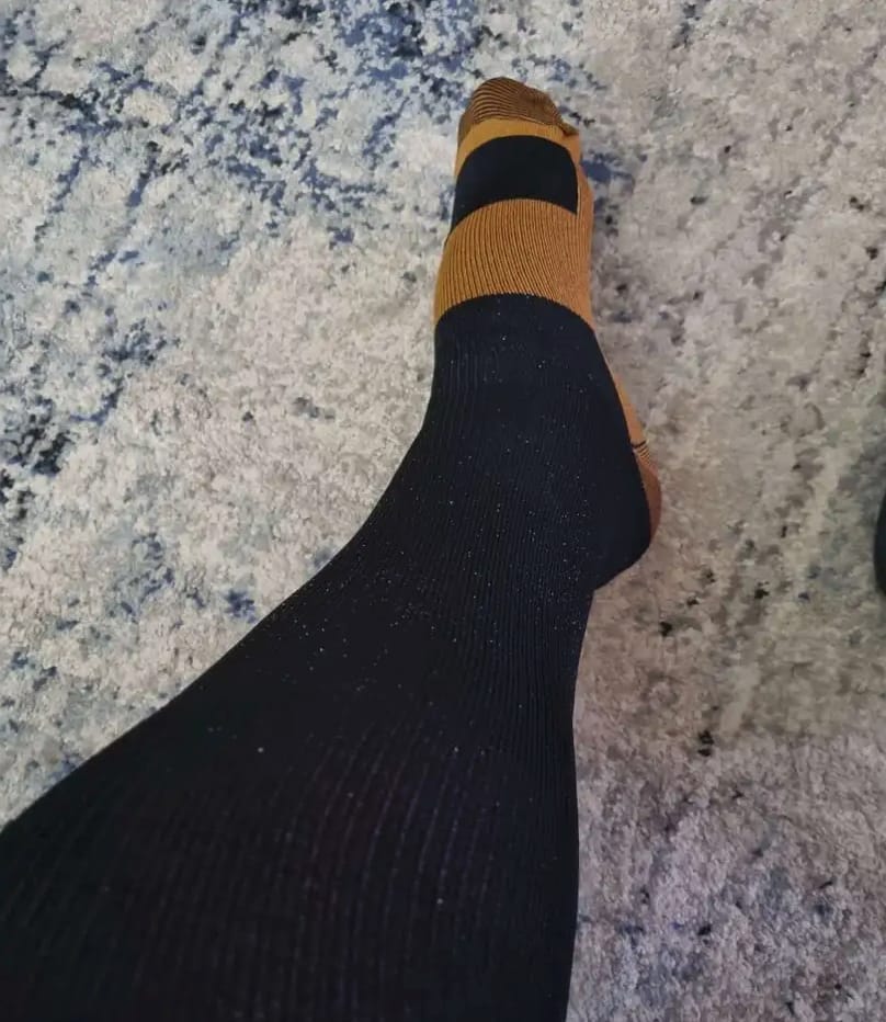 Customer photo review of Armadilo Performance Compression Socks