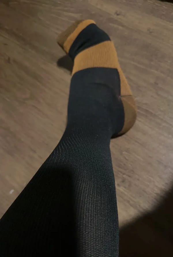 Customer photo review of Armadilo Performance Compression Socks