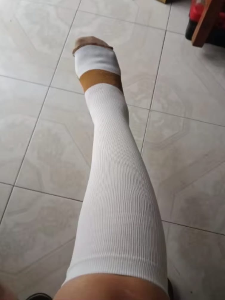 Customer photo review of Armadilo Performance Compression Socks