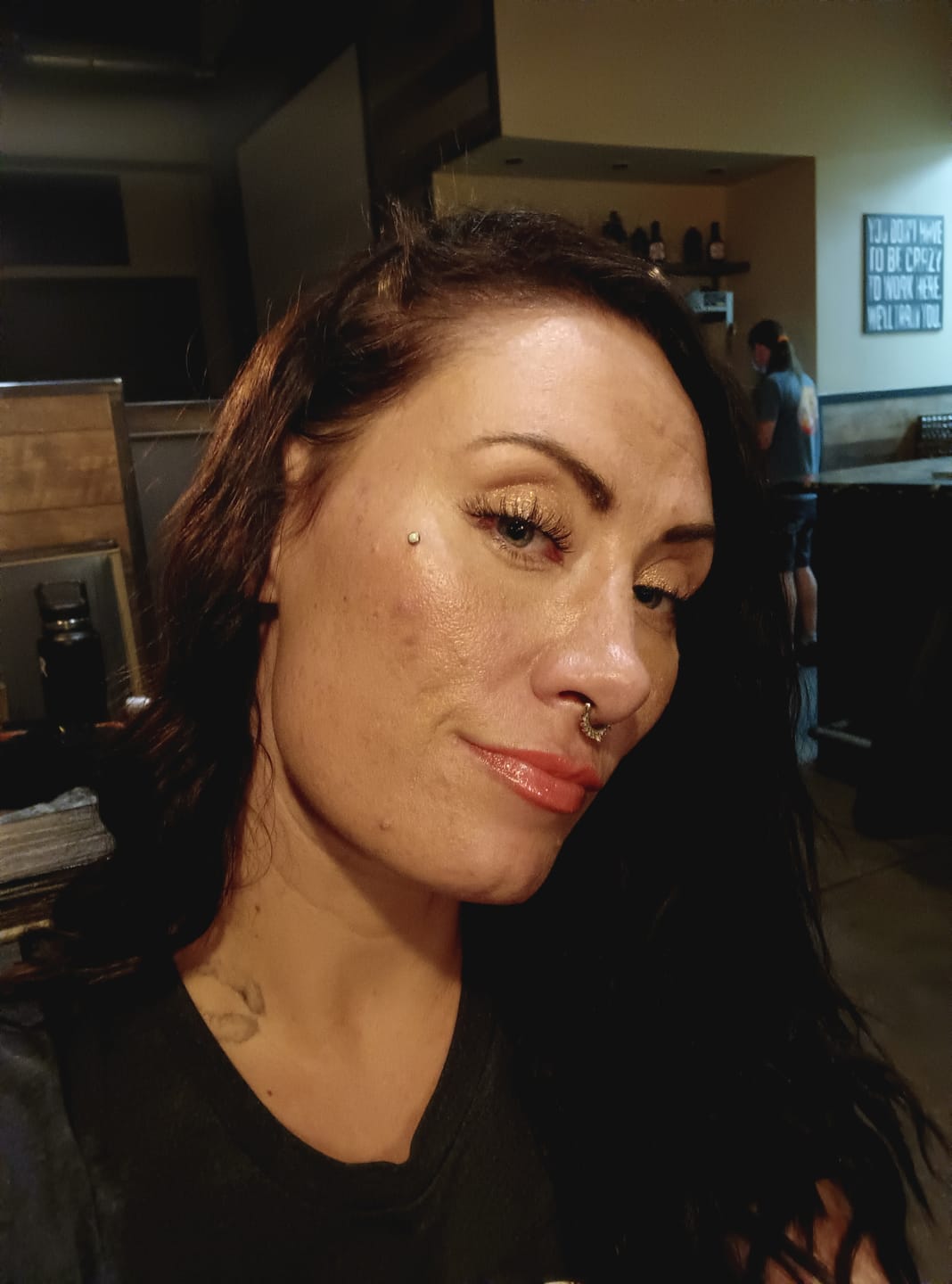 Customer photo review of The Complete Acne System for Women
