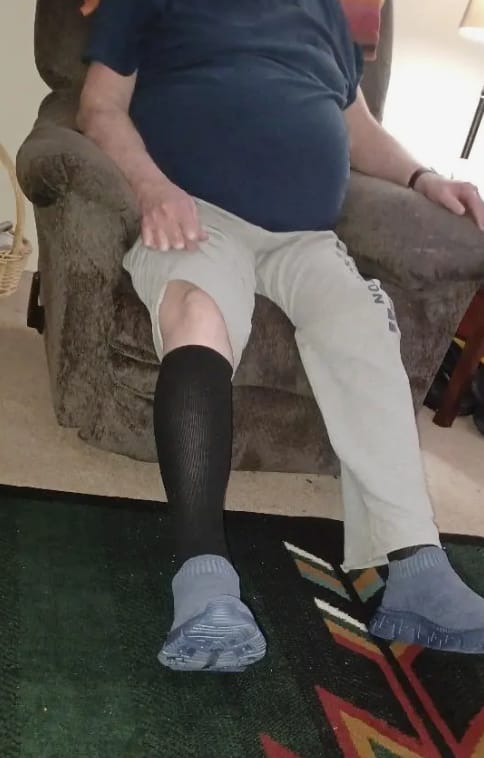 Customer photo review of Armadilo Performance Compression Socks