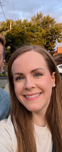 Customer photo review of Rose Gold Stardust Speckles Makeup Patches