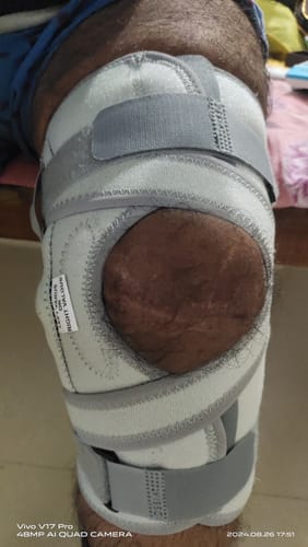 Customer photo review of OA Knee Brace - Open Type (Left/Right) | Offloads the Pressure on the Knee (Grey)
