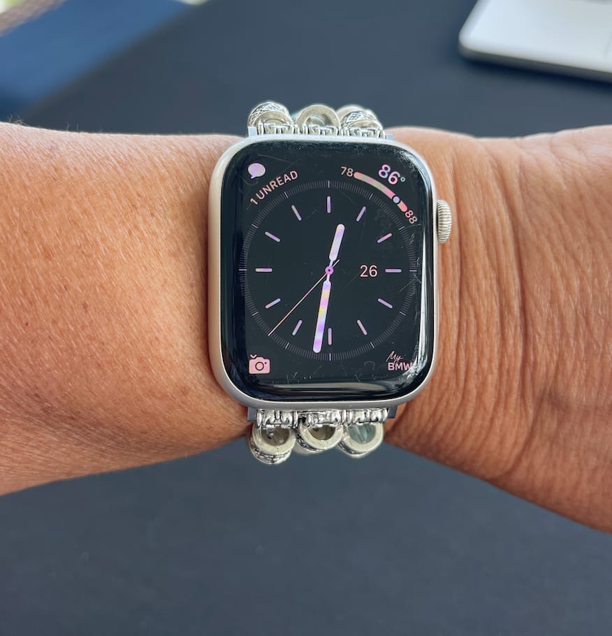 Customer photo review of Amazon Blue Ocean Stretch Watch Strap