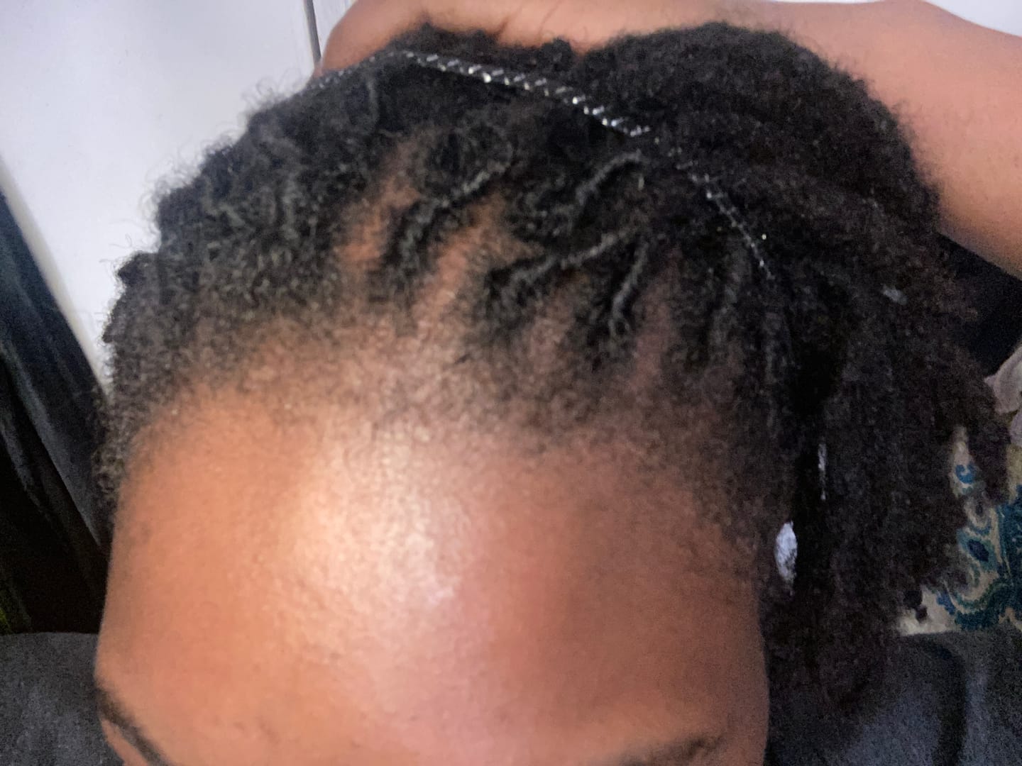 Customer photo review of Plant Based Loc & Scalp spray