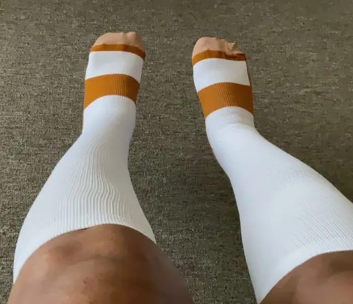 Customer photo review of Armadilo Performance Compression Socks