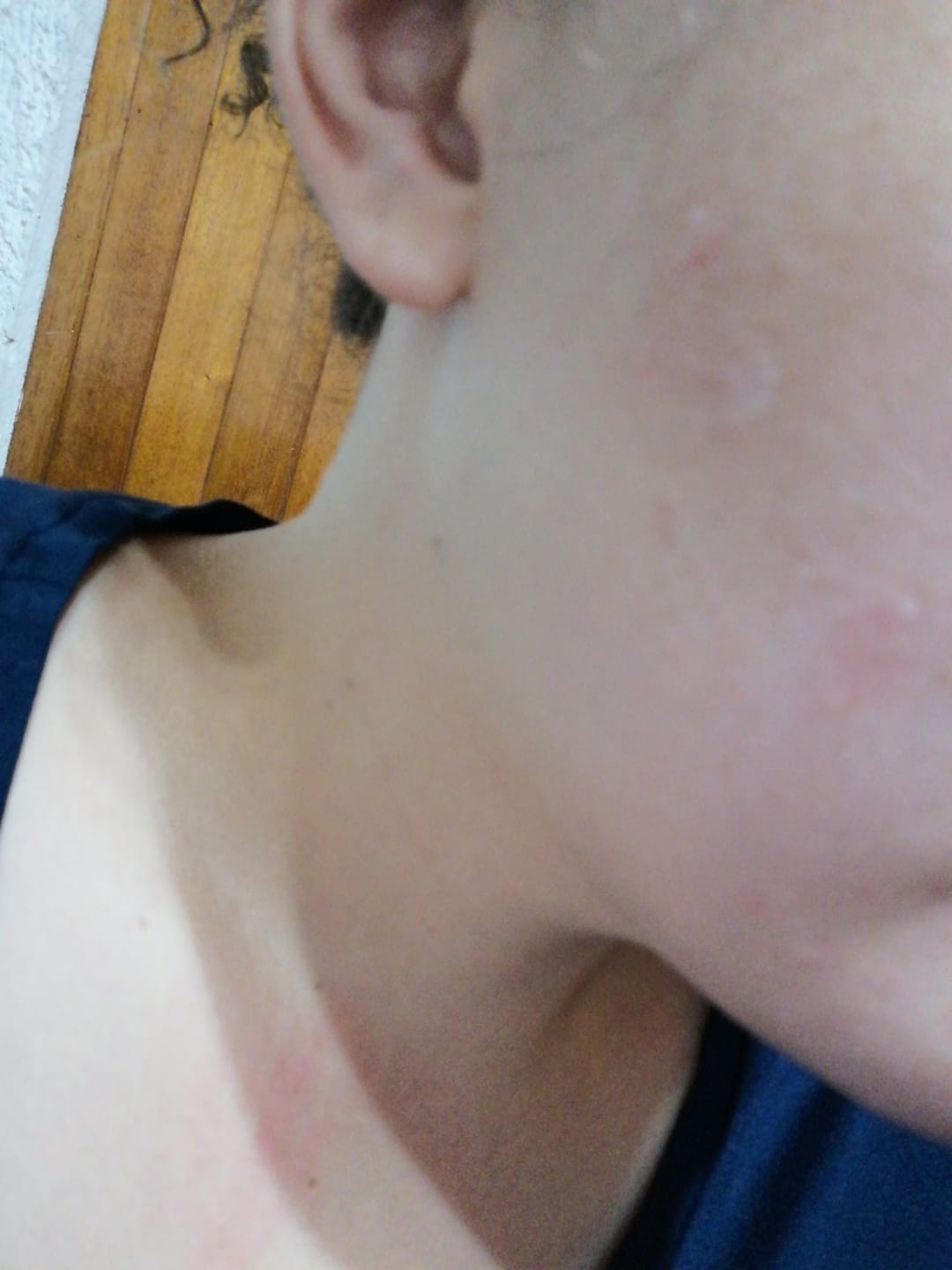 Customer photo review of Madagascar Centella Ampoule