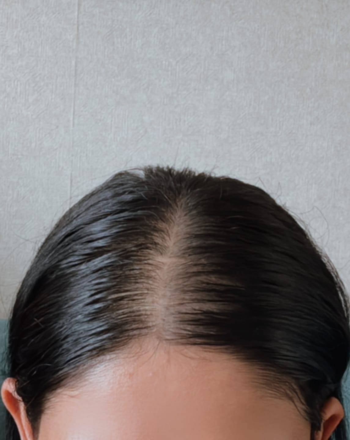 Customer photo review of Hair Growth Kit