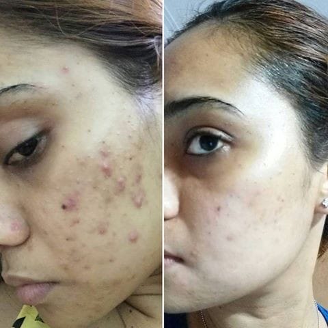 Customer photo review of Ultra C: Vitamin C Serum