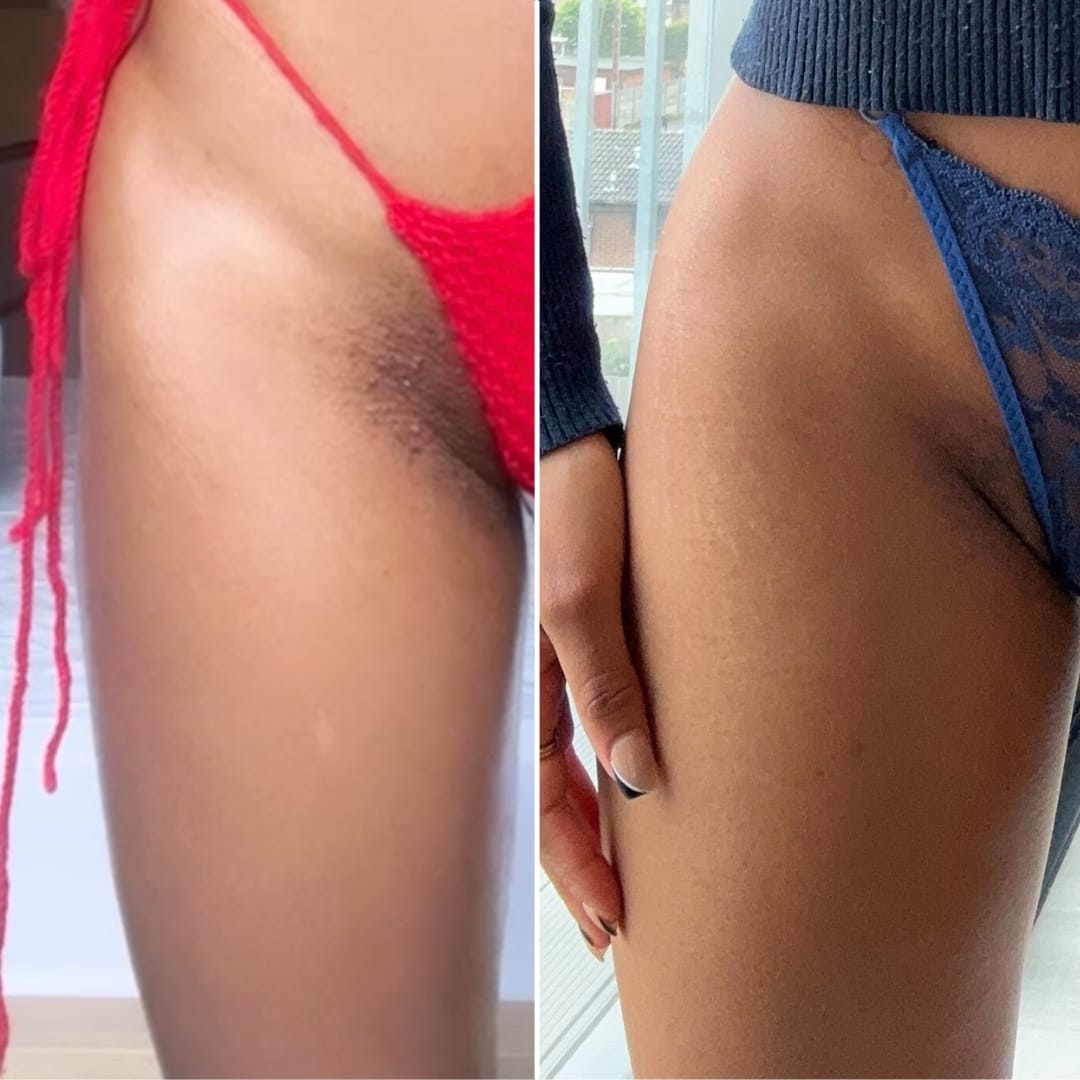 Customer photo review of Superfood Intimate Care Kit