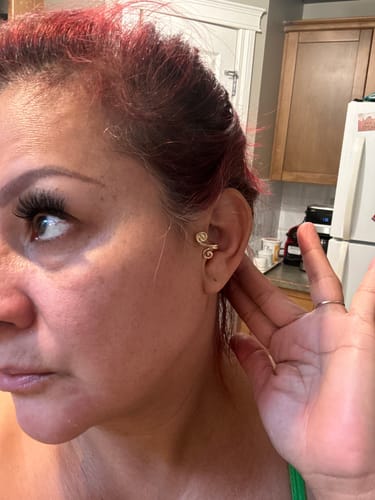 Customer photo review of (Limited Time Discount 🔥 Last Day)Histone Acupressure Slimming Earrings
