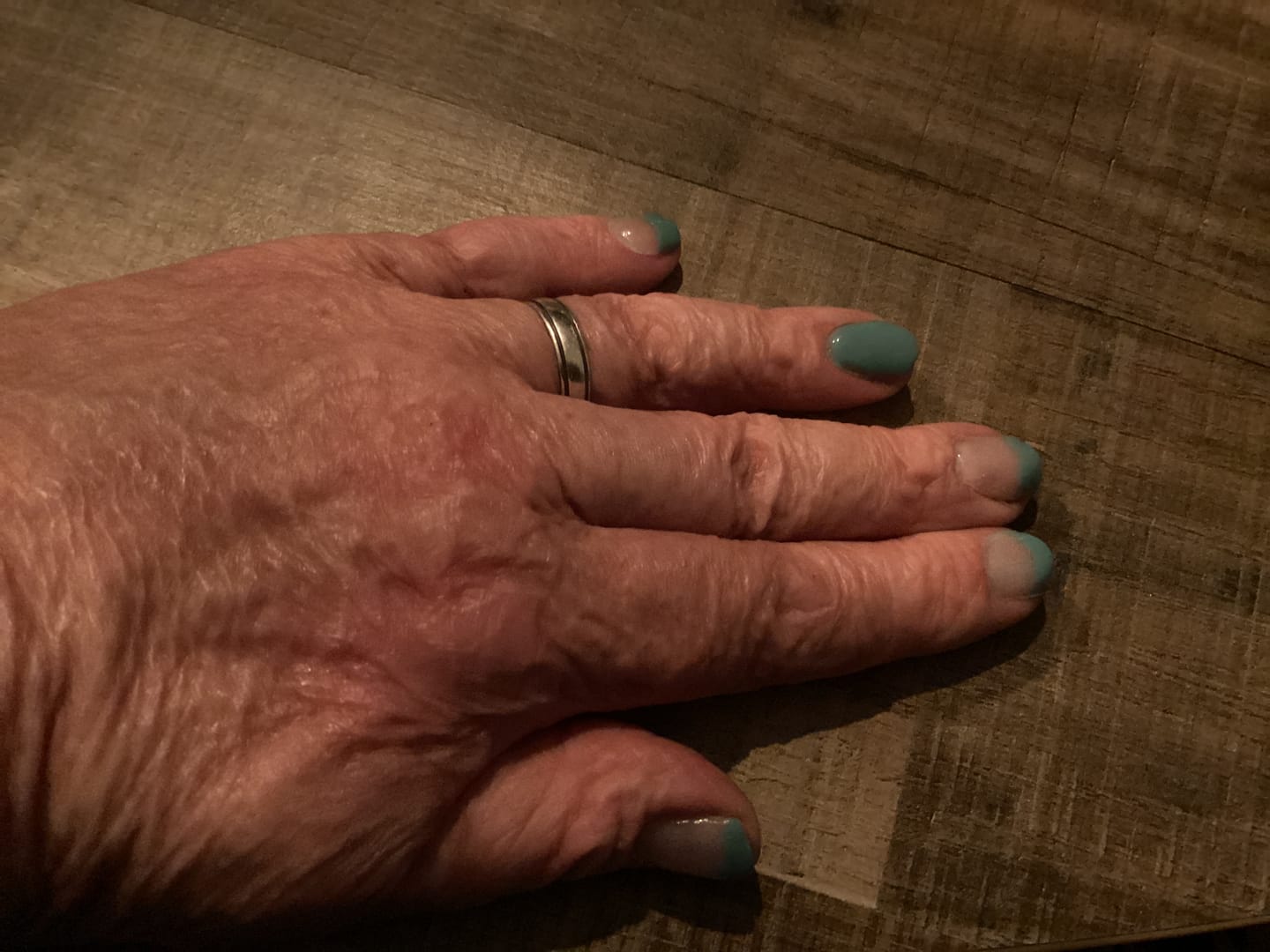 Customer photo review of Basis Accessoires Set