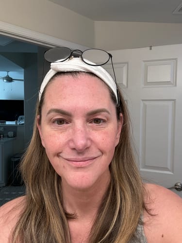 Customer photo review of The Complete System for Mature Women’s Skin