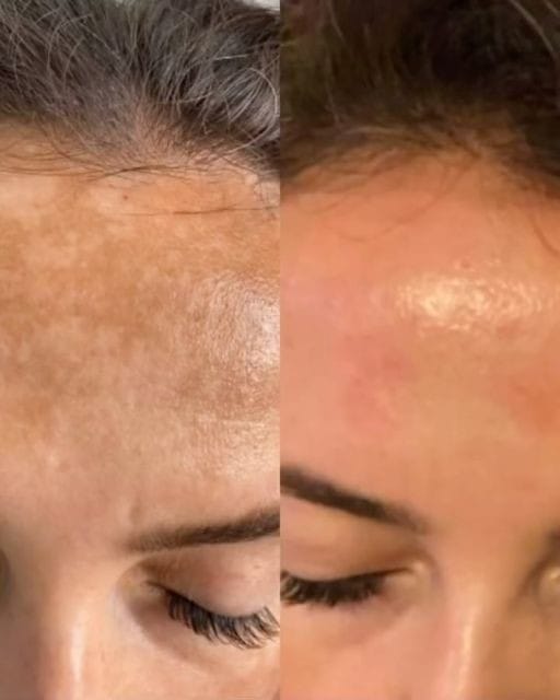 Customer photo review of Ultra C: Vitamin C Serum