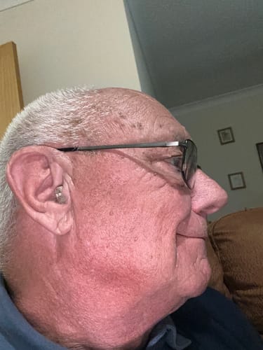 Customer photo review of Rechargeable Invisible Hearing Amplifiers | Hearing Aids with Wireless Charging Case