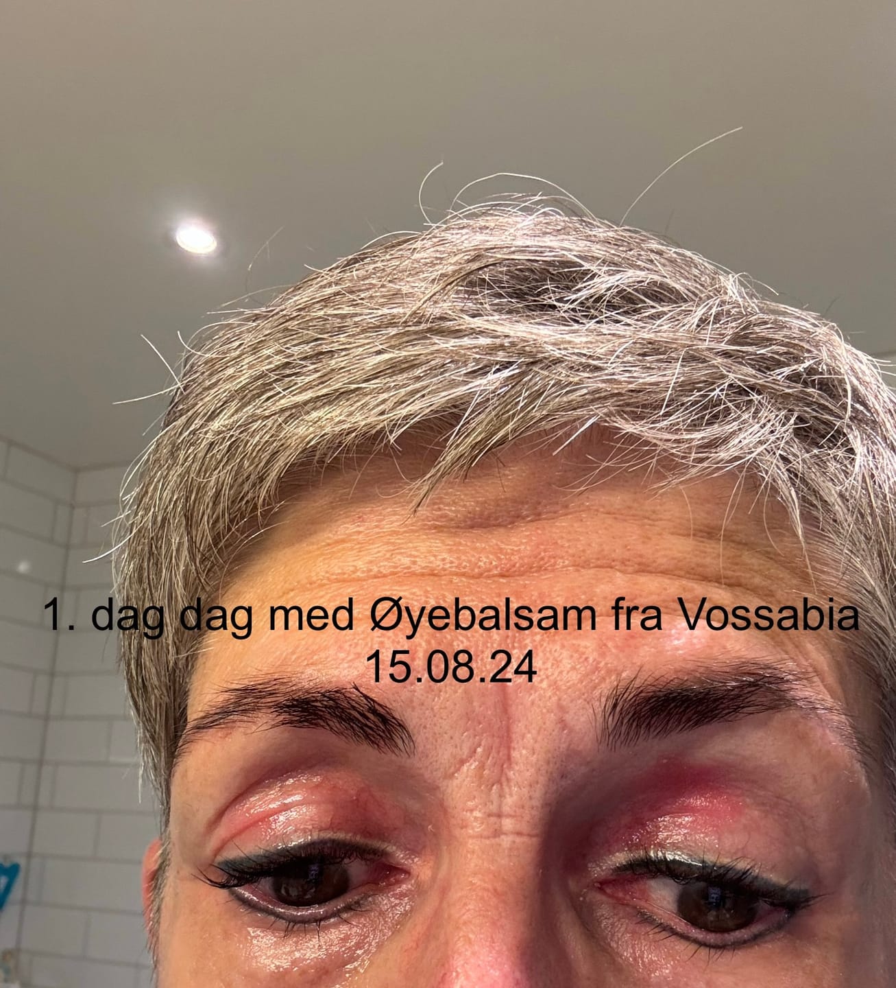 Reseña fotográfica de un cliente sobre el bálsamo para ojos