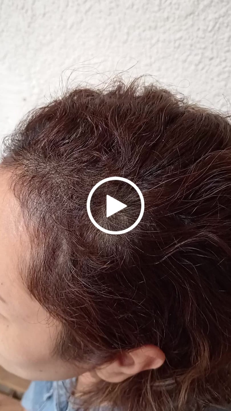 Customer video review of HAIRtamin Fórmula Avanzada