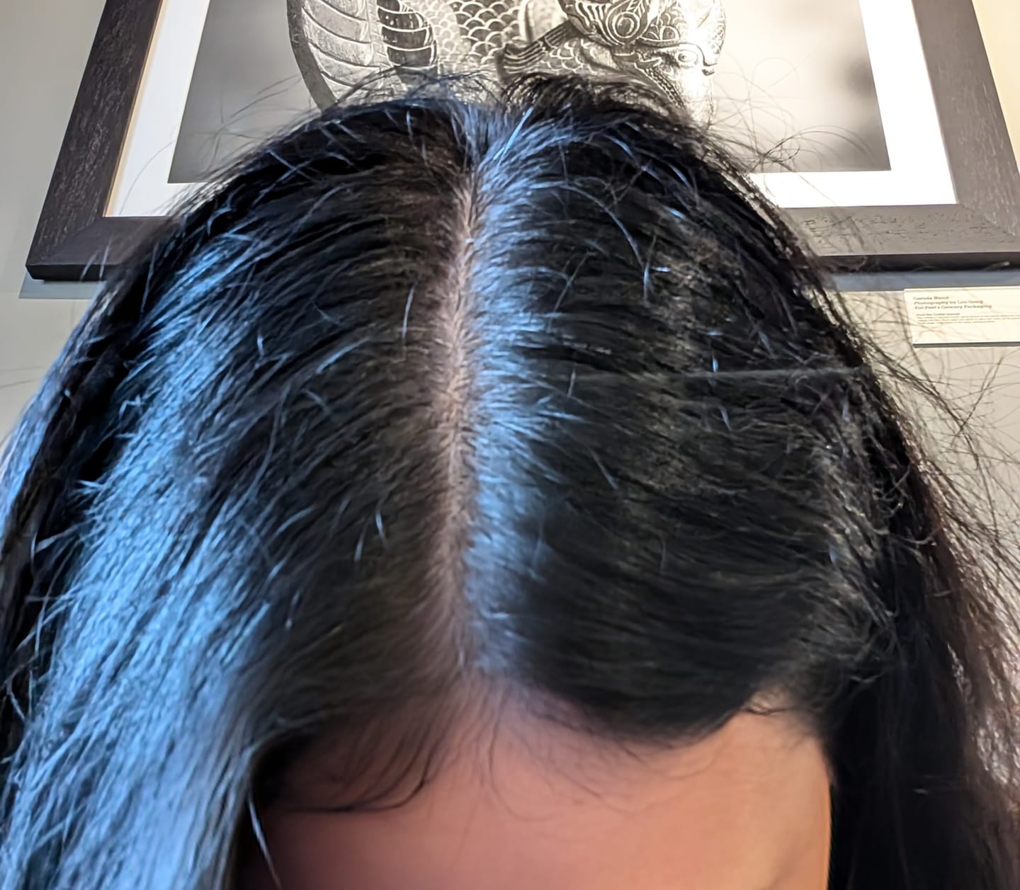 Customer photo review of Zone 3™ Blood Panel (Inflammatory Hair Loss)