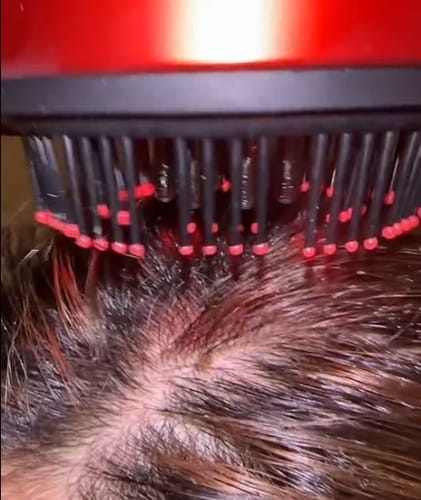 Customer photo review of Glowera™ 3 in 1 Red Light Scalp Massager
