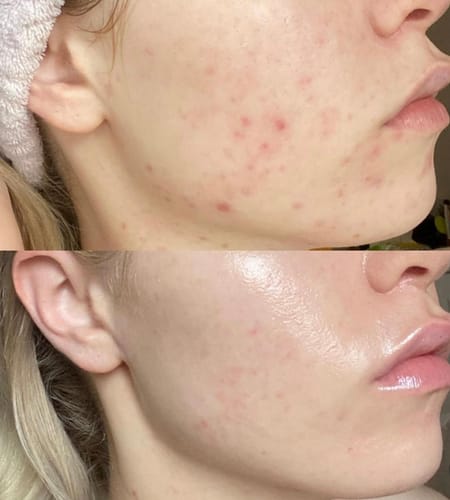 Customer photo review of Tisane Glow up ®