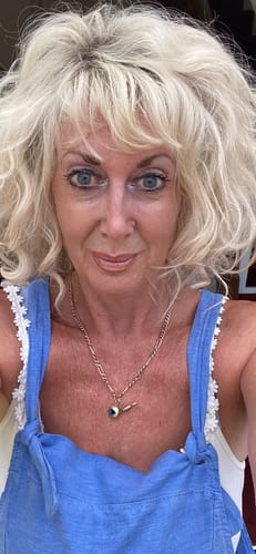 Customer photo review of Rosalique 3 in 1 Anti-Redness Miracle Formula SPF50