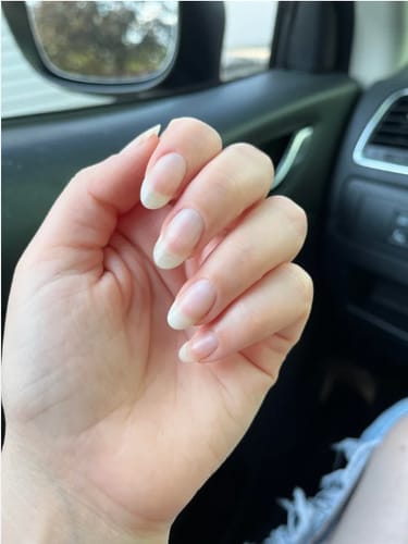 Customer photo review of NailShine - pflegendes Nagelwachstumsserum