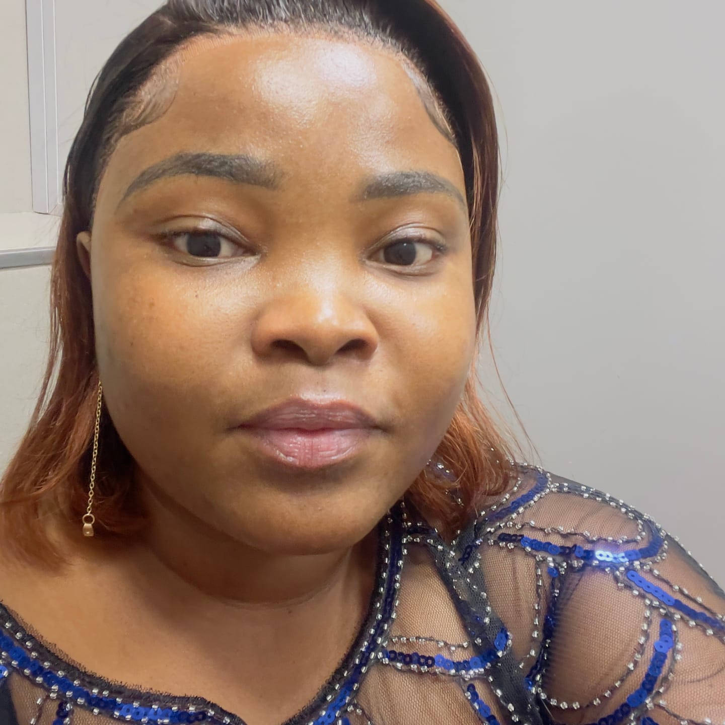 Customer photo review of Gmaeum Clear Complexion Set