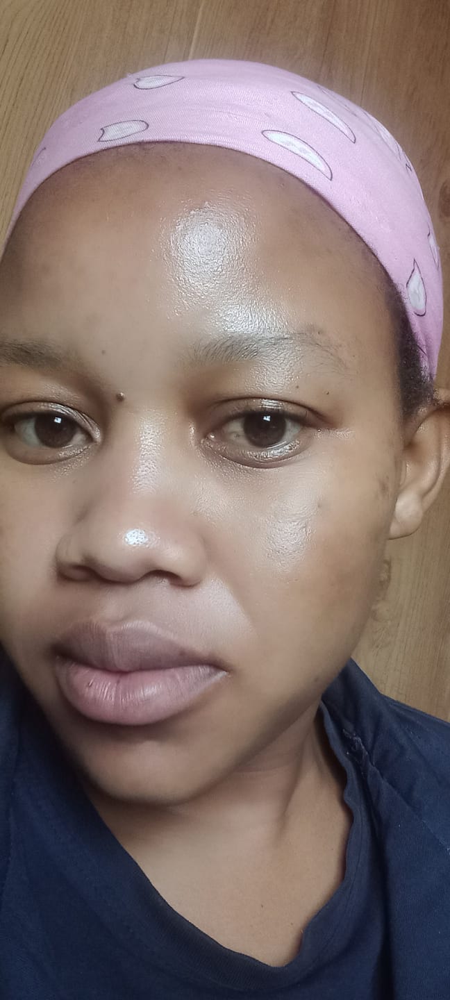 Customer photo review of Gmaeum Clear Complexion Set
