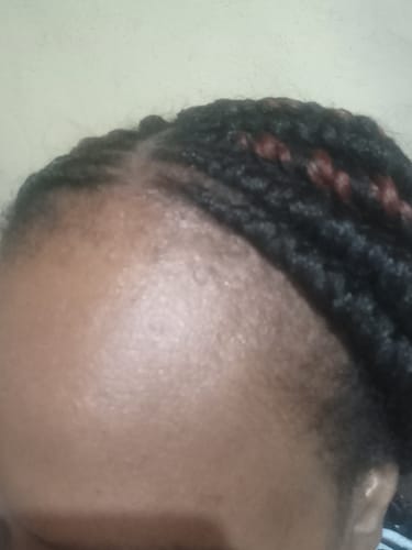 Customer photo review of Hair & Nail Capsules