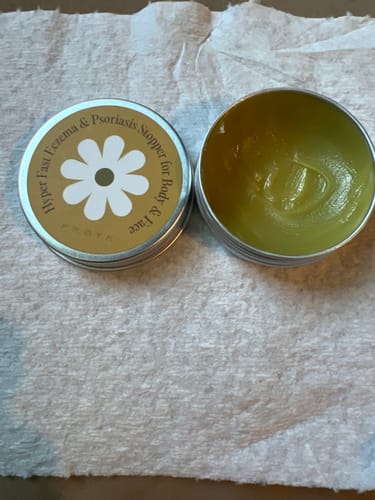 Customer photo review of Ultra-Fast Relief Balm for Dry, Itchy Skin – For Body & Face