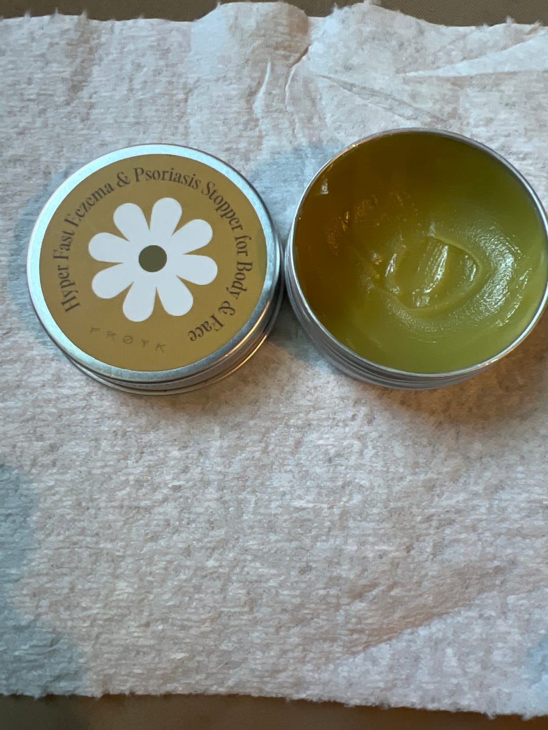 Customer photo review of Ultra-Fast Relief Balm for Dry, Itchy Skin – For Body & Face