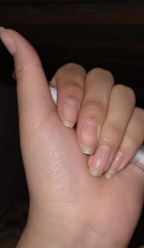 Customer photo review of NailShine - pflegendes Nagelwachstumsserum
