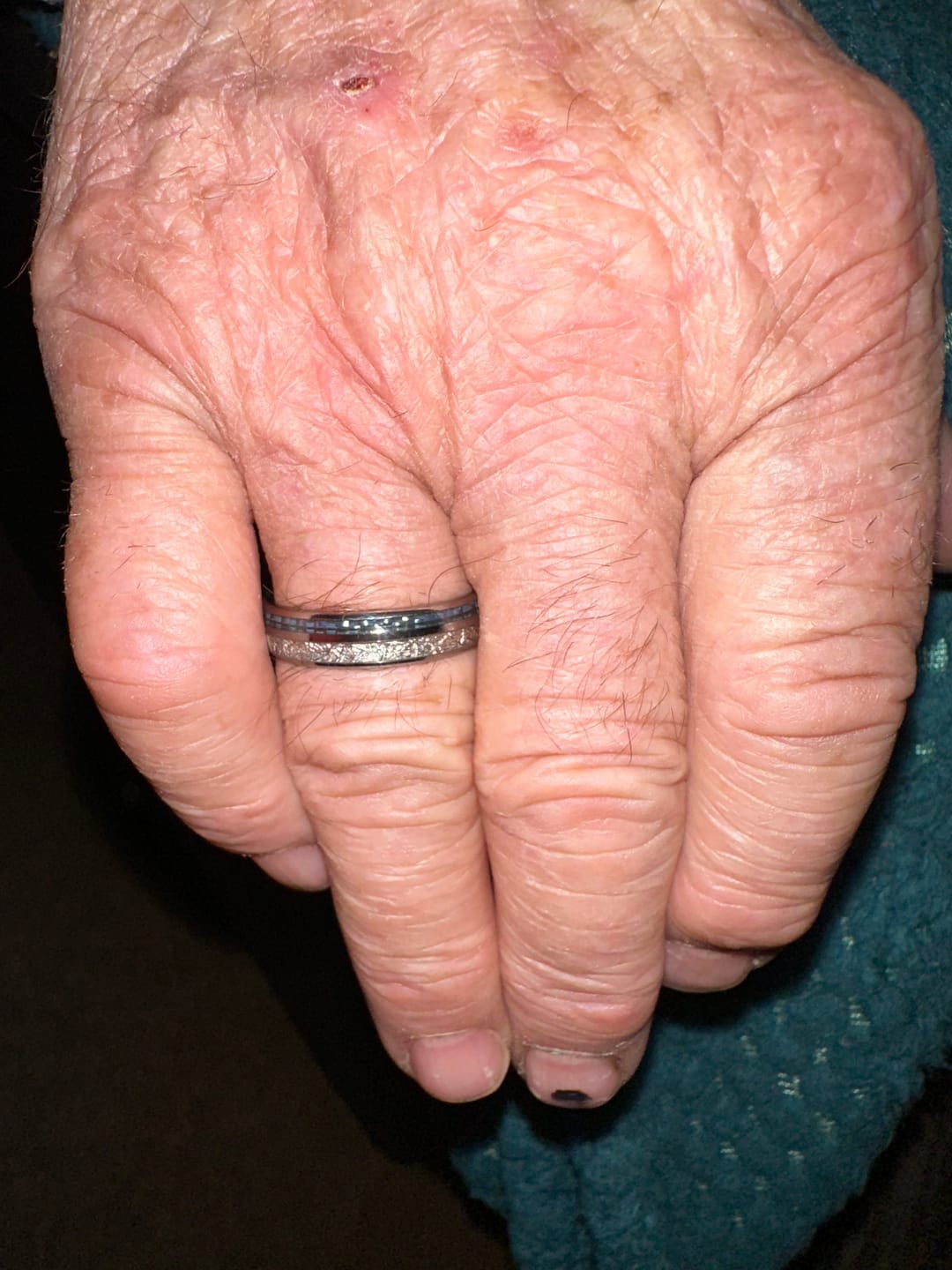 Customer photo review of The Steely Blue 6mm Wonder Ring