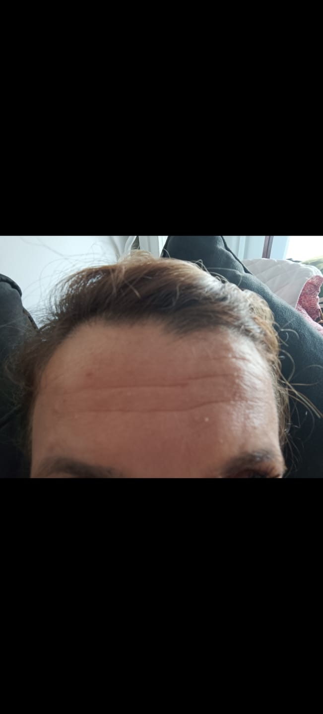 Customer photo review of [IN] YOUTH Cure Anti-Âge